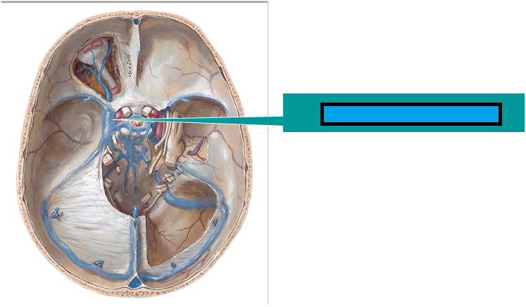 meningiome frontal droit