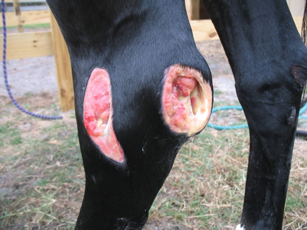 Pictures+of+Bad+Wounds Pictures of Bad Wounds http://zahnarzt-salzweg.com/15/4-really-bad ...